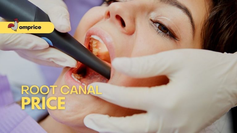 Cover Root Canal Price in Philippine Jomprice