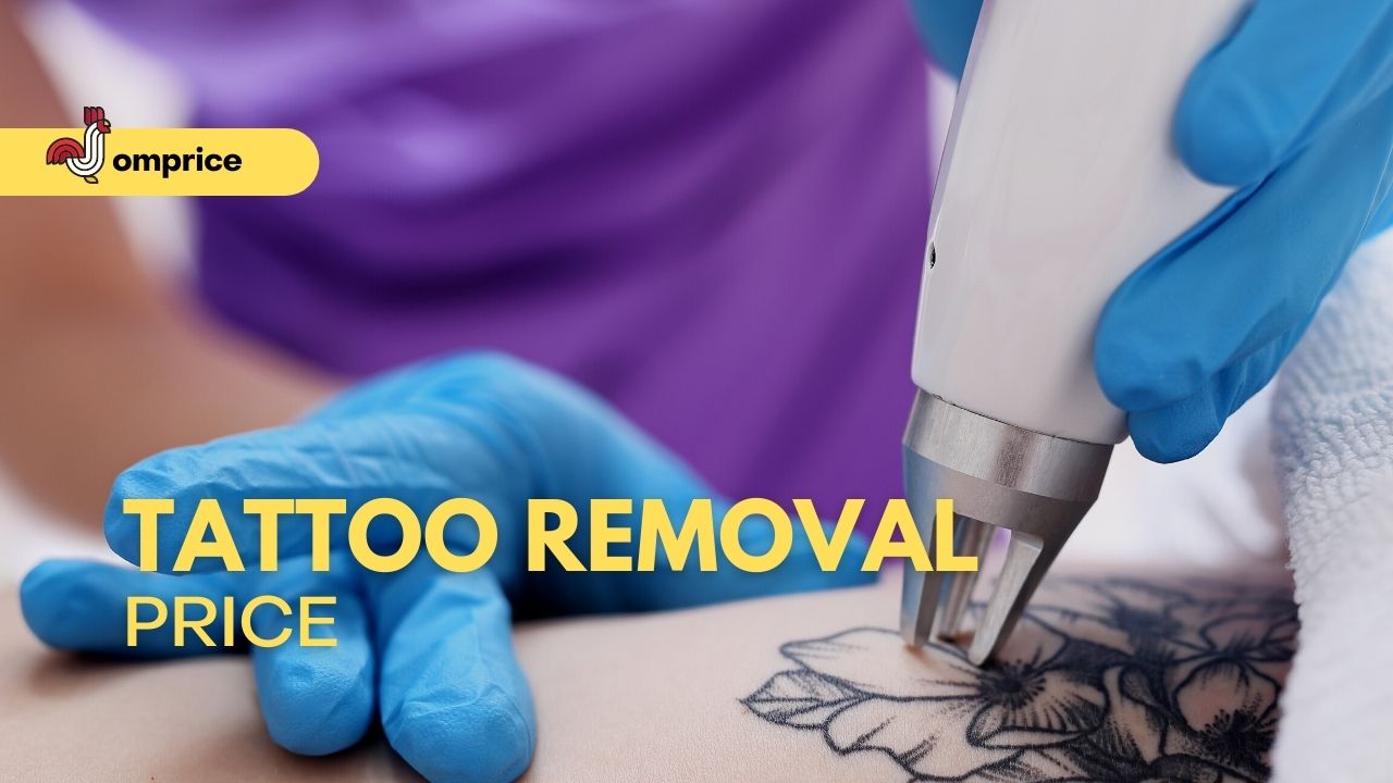√ (Update) Tattoo Removal Price Philippines 2023