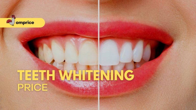 Cover Teeth Whitening Price in Philippines Jomprice image