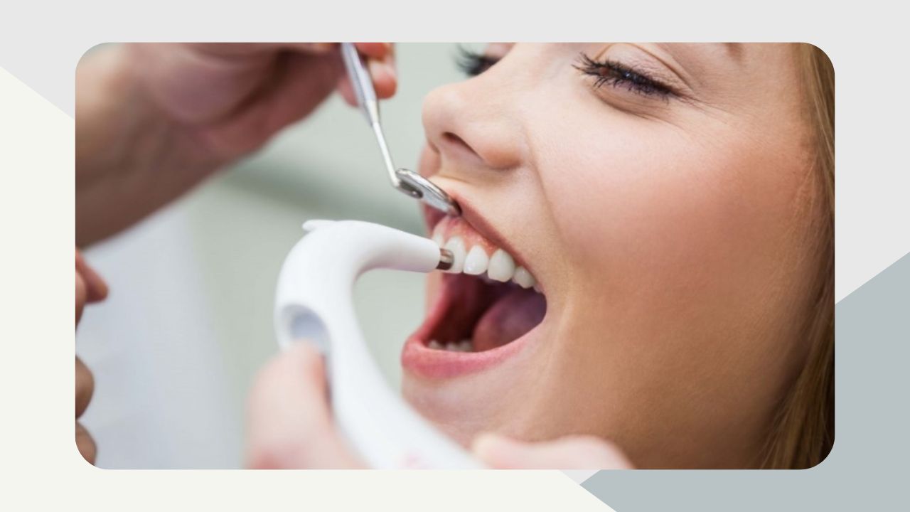 Prophylaxis Teeth Cleaning
