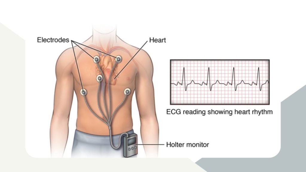 Holter Monitor image