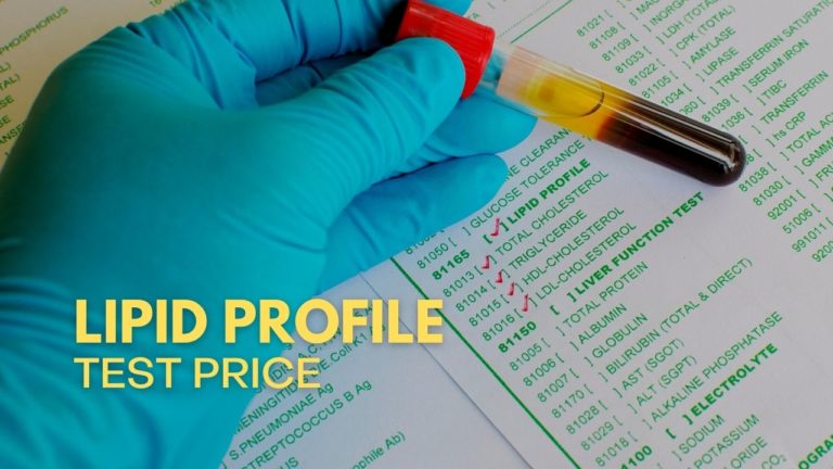 Cover Lipid Profil Test Price in Philippines