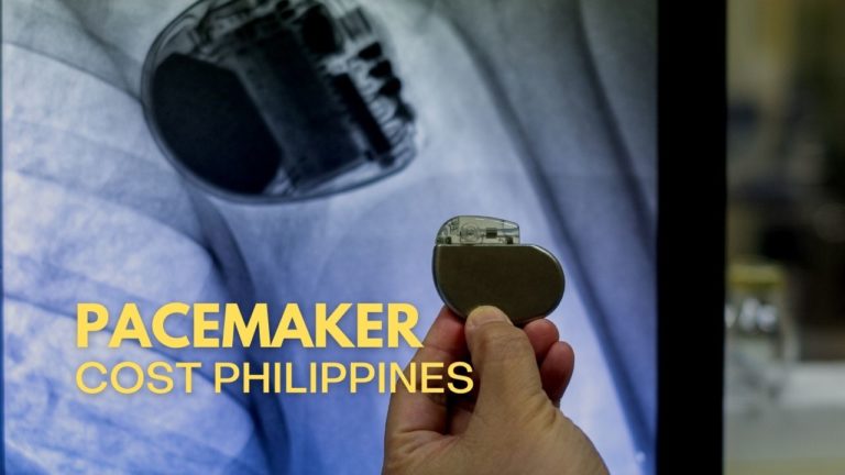 Cover Pacemaker Cost in Philippines