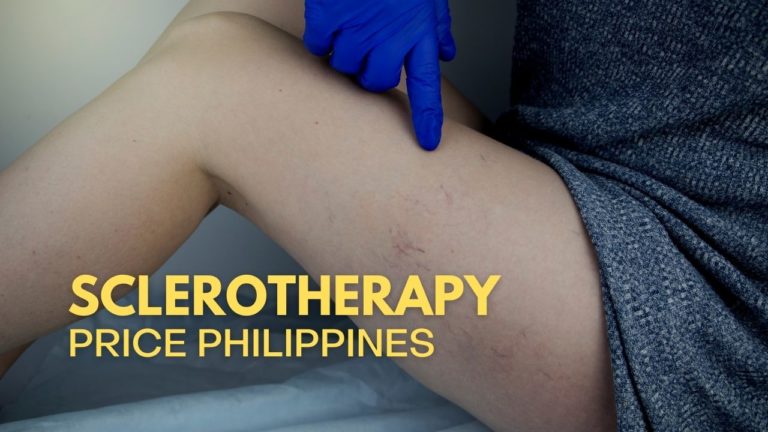 Cover Sclerotherapy Price in Philippines