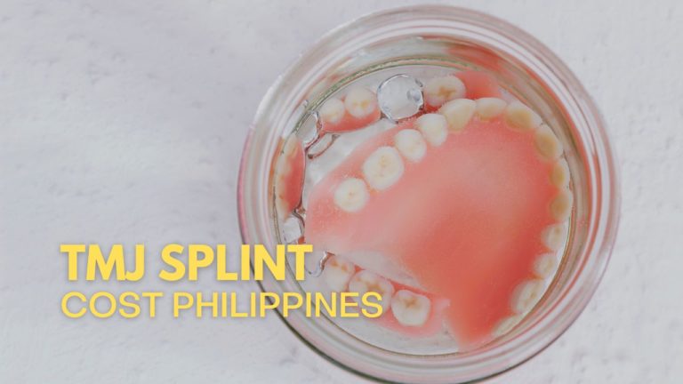 Cover TMJ Splint Cost in Philippines
