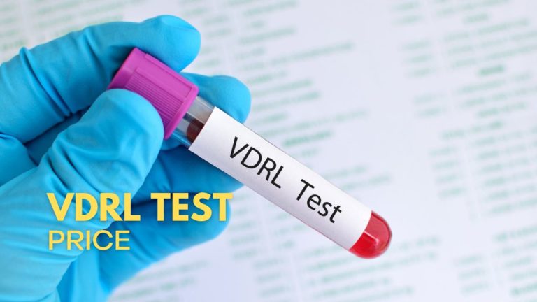 Cover VDRL Test Price in Philippines