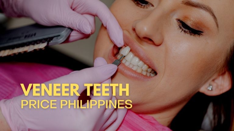 Cover Veneer Teeth Price in Philippines