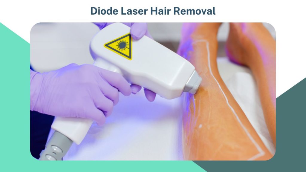 Diode Laser Hair Removal image