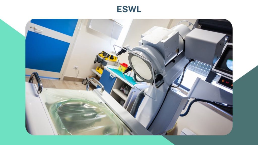 Extracorporeal shock wave lithotripsy ESWL or piezoelectricity image