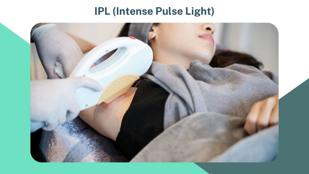 IPL Intense Pulse Light image