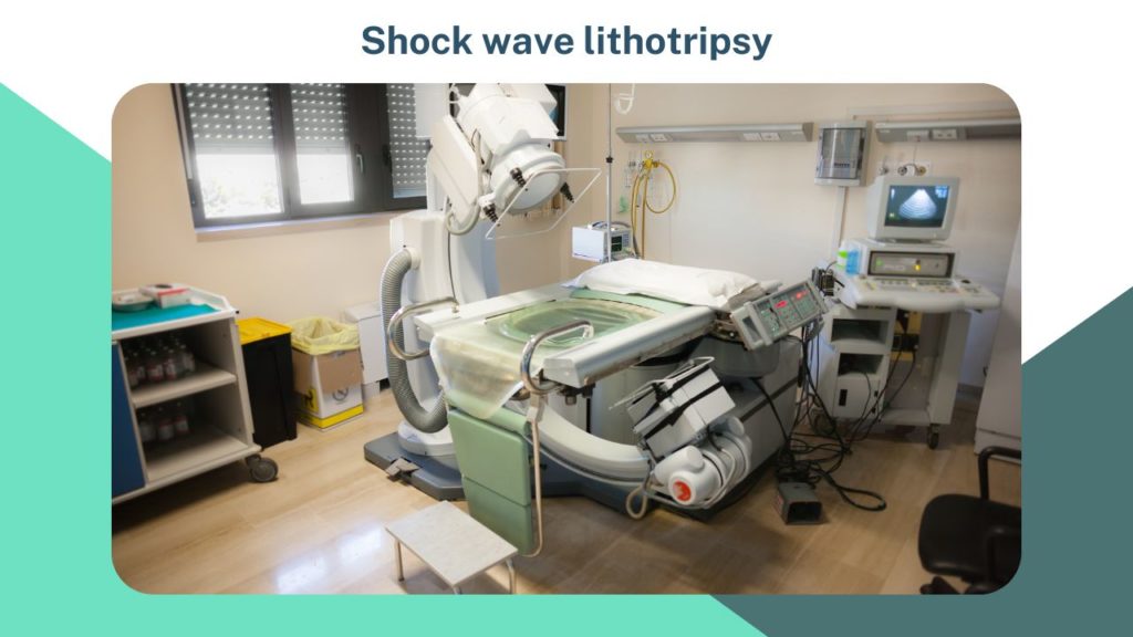 Shock wave lithotripsy image