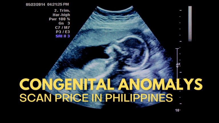 Cover Congenital Anomalys Scan Price in Philippines