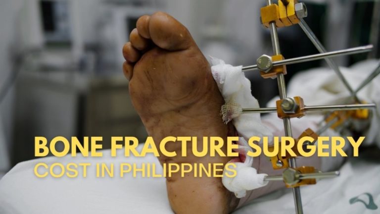 Cover-Bone-Fracture-Surgery-Cost-In-Philippines