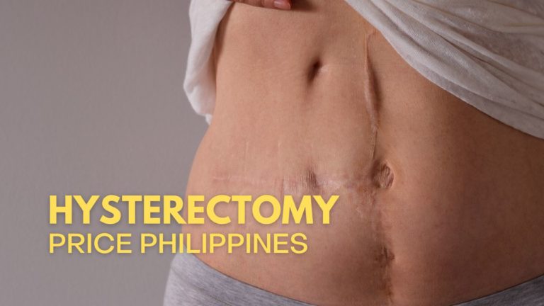 Cover Hysterectomy Price In Philippines